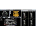 X-VIEW 3D - панорамний томограф Trident Dental